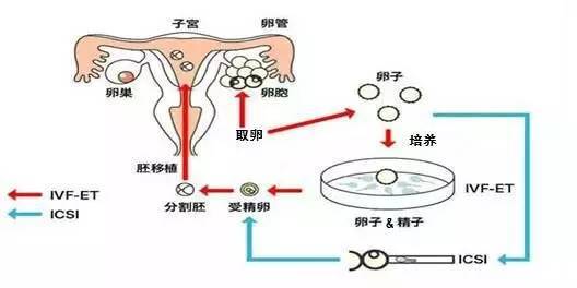 厦门做试管婴儿的费用因不同的医院、技术和个人情况而异，一般在5-15万元之间。